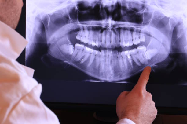 Best Emergency Treatment for Toothache in Moundridge, KS