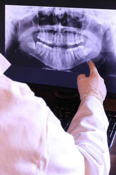 Best Emergency Tooth Extraction in Moundridge, KS