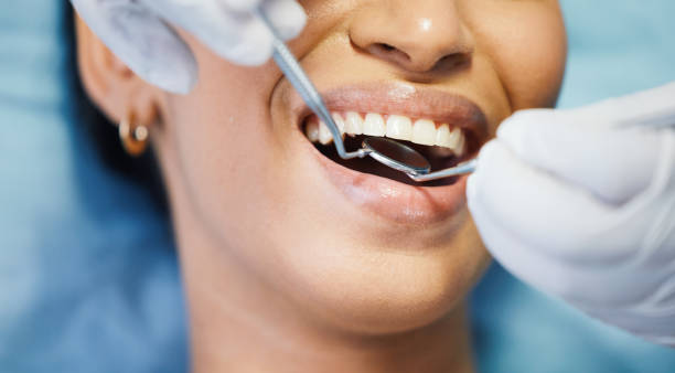Best Emergency Wisdom Teeth Removal in Moundridge, KS
